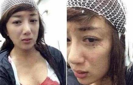 明星网红整容毁容视频,毁容还是逆袭？揭秘明星网红整形风险
