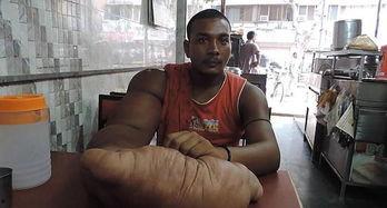 黑臂男网红吃瓜,揭秘网红圈幕后故事